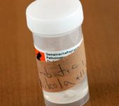 Souvenirs f�r Nikola Karabatic: Die entfernten freien Gelenkk�rperchen.