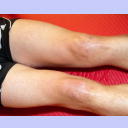 Filip Jicha in der Reha.