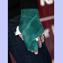 Die gebrochene Hand von Kim Andersson.